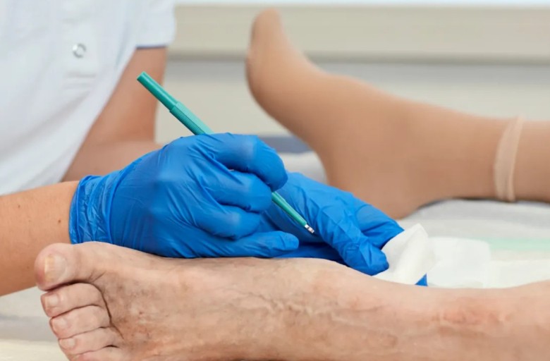 debridement.jpg